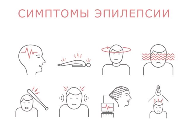 Симптомы алкогольной эпилепсии